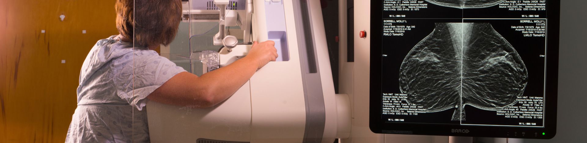 image for blog headline Understanding Mammograms: Straight Answers Before You Schedule